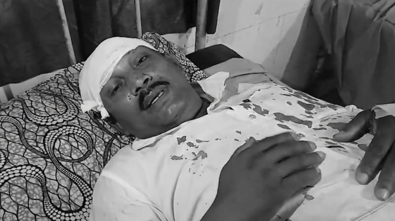 बंगाल चुनाव: मतदान में कई जगह हिंसा की घटनाएं, दक्षिण 24 परगना में भाजपा प्रत्याशी की गाड़ी पर हमला बंगाल चुनाव: मतदान में कई जगह हिंसा की घटनाएं, दक्षिण 24 परगना में भाजपा प्रत्याशी की गाड़ी पर हमला