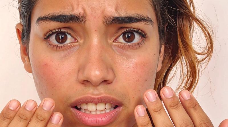 तेज धूप में बढ़ा सनबर्न का खतरा, एलोवेरा, खीरा और गुलाब जल से पाएं राहत तेज धूप में बढ़ा सनबर्न का खतरा, एलोवेरा, खीरा और गुलाब जल से पाएं राहत