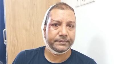 मुझे घेरा गया और हमला किया, उनके पास लाठियां और पत्थर थे : इंस्पेक्टर नंद किशोर सिंह