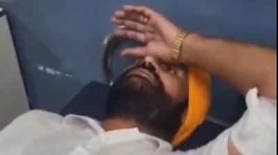 अमृतसर में जीआरपी के एएसआई पर जानलेवा हमला, कंधे को छूकर निकली गोली,