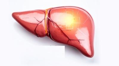 लिवर के लिए जहर समान ज्यादा चीनी, फास्ट फूड और तेल, इन बातों का रखें खास ध्यान