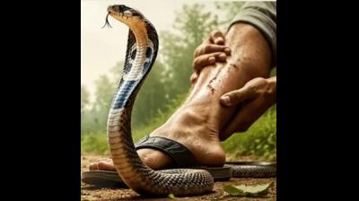 सर्पदंश में गलत घरेलू उपाय जानलेवा, एक्सपर्ट से जानें क्या करें, क्या नहीं