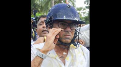 बंगाल: अभिषेक को दूसरे अस्पताल में भर्ती कराया गया, ममता बनर्जी ने लगाए गंभीर आरोप